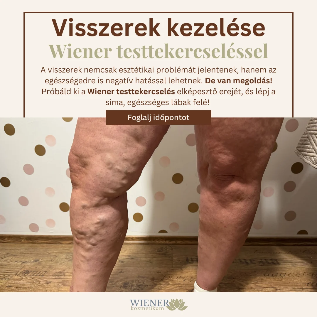 Wiener testtekercselés természetes eredmény